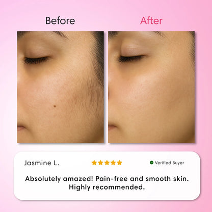 LumeLux Hair Removal Trilogy Kit