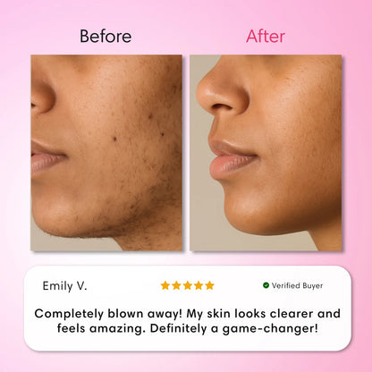 LumeLux Hair Removal Trilogy Kit