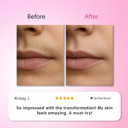 LumeLux Hair Removal Trilogy Kit